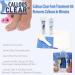 Callous Clear(TM) Foot Treatment Kit - Fast Callus Removal in Minutes - Buy Online on GoSupps.com
