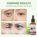 MagiForeign 30ml Aloe Vera eye serum eye care eye cream against eye rings and puffiness reduced tear bags creases and fine lines antiaging eye care serum for men and Fr - Buy Online on GoSupps.com
