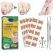 Treatment Ingrown Toenail Corrector Strips,Fitmedify Nail Patches with Nail Correction Tool Kit,Toenail Correction Patch,Ingrown Toenail Removal Kit