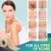 Professional Silicone Scar Sheets Roll - 1.6 x 150 - Scars Removal Treatment for Keloid, C-Section, Surgery, Burn, Acne - Reusable Tape Strips - Buy Online on GoSupps.com