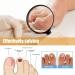 Fungal Nail Treatment Nail Repair Patches Restores Damaged Nails Nail Fungus Treatment for Toenail Gently Effectively Nail Care Anti Fungal Repair Patches Restores Healthy Nails - Buy Online on GoSupps.com
