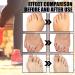 ERGOic Bunion Relief Socks - Anti-Bunion Health Socks for Women and Men - Bunion Corrector Toe Align Socks (Black 5 Pairs) - Buy Online on GoSupps.com