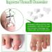 MDYBF ingrown toenail kit ingrown toenail corrector Ingrown Toenail Treatment Kit - Corrector for Pain Relief Nail Growth Correction and Fungus Prevention - Buy Online on GoSupps.com