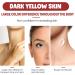 Neck Tightening Cream - Neck Firming Cream with Retinol and Collagen - Rich in Hyaluronic Acid Neck Cream Tightening Lifting Sagging Skin - Women's Anti Wrinkle Moisturizer Neck - Buy Online on GoSupps.com