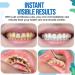 Whiteout Instant Teeth Whitening Paint - Instant Teeth Whitening (2 Pack) | Brighten Your Smile Quickly! - Buy Online on GoSupps.com