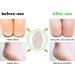 Uoking Pumice Stone for Feet - 2 PCS Natural Lava Scrubber & Callus Remover - Buy Online on GoSupps.com