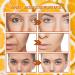Vitamin C Face Mist Vitamin C Serum Spray For Face Anti Aging Face Spray Face Serum Lifting & Firming Mask And Spray Hydrating Mist Deeply Moisturizing & Skin Brightening Spray - Buy Online on GoSupps.com