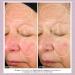 Droplette Daily Defense Refill Capsules - Improve Skin with Tranexamic Acid Retinol & Collagen | Summer Skin Care Regimen (28 Count) - Shop Internationally - Buy Online on GoSupps.com