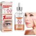Milia S rum d maquillant pour le contour des yeux S rum facial contre les miliums et les taches brunes pour homme et femme r duit le rel chement de la peau les gonflements et les ridules 30 ml 1 pi ce. - Buy Online on GoSupps.com