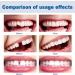 DIY Tooth Repair Set | Make Your Own Dentures & Fillings | Polymorph Teeth Solutions for Instant Fixes - Buy Online on GoSupps.com