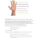 Purple Small Acupressure Bracelet for Morning Sickness Dizziness & Anxiety - Waterproof Elastic Tape - 15.2 cm Pair - Buy Online on GoSupps.com