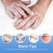 Vitiligo Cream for Skin Pigmentation | Reduce White Spots Treatment - Buy Online on GoSupps.com