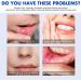 Mouth Ulcer Spray Ulcer Breath Sprays Mouth Ulcer Treatment Spray Ulcer Treatment Canker Sore Treatment Canker Relief Spray Oral Ulcer Sprays Herbal Mouth Spray Dry Mouth Relief Treat Mouth Ulcer - Buy Online on GoSupps.com