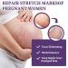 Effective Scar Cream for Old & New Scars | Smooth Skin Care - 30 ml | International Shipping Available - Buy Online on GoSupps.com