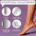 Lee Beauty Callus Remover - Professional Foot File Scrubber for Cracked Heels & Dead Skin - Easy to Use Pedicure Tool for Smooth Feet - International Shipping - Buy Online on GoSupps.com