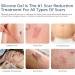 ARA Silicone Scar Gel Removal Cream for C-Section & Stretch Marks 1.6 Oz - Buy Online on GoSupps.com