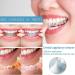Retainer Cleaner Aligner Cleaner Clear Retainer Cleaner Teeth Aligner Foam Retainer Whitening Foam Retainer Cleaning Spray for Oral Appliances Dentures Retainers and Aligners Fights Bad Breath 60ml - Buy Online on GoSupps.com
