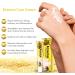 Doxenem Eczema & Psoriasis Cream - Control Reoccurrence, Tinea Versicolor Treatment, Dark Spots Relief for Adults - Buy Online on GoSupps.com