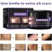 Scar Removal Cream 50ml - C-Section Skin Repair, Stretch Marks & Acne Surgery Treatment - Buy Online on GoSupps.com