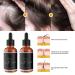 2023 Allurium Hair Growth Serum for Black Women - Pack of 4 | Anti Hair Loss, Nourishing, Repairs Damaged Hair | 1 Fl Oz - Buy Online on GoSupps.com