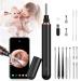 AWELOR Ear Wax Removal Ear Cleaner with Camera,1296P HD Endoscope Earwax Remover Tool with 6 LED Lights,Wireless Ear Otoscope Ear Cleaning Tool for iPhone, iPad & Android Smart Phones