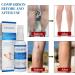 30ml Blood Vein Leg Relief Spray | Promote Circulation & Smooth Veins | Vasculitis Support | Foot Masks & Lipstick Remover | White One Size - Buy Online on GoSupps.com