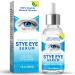 Stye Eye Treatment Natural Stye Eye Relief Serum for Styes Chalazion and Blepharitis Restored Healthier Eye Skin Blue - 1 Oz