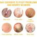Fungal Nail Treatment For Toenails Extra Strong - Nail Fungus Treatment - Moisturize Cuticle Care Oils for Ingrown Toenails - Toenail Growth for Repairing Damaged & Discolored Nails(30ML) - Buy Online on GoSupps.com
