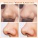 UIOOIU Blackhead Remover Vacuum - Pore Cleaner Tool with 3 Suction Modes for All Skin Types-Men & Women - Buy Online on GoSupps.com