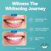 14day Teeth whitening Strips + Teeth whitening Powder - Buy Online on GoSupps.com