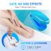 Nail Fungus Laser Treatment Device for Toenails and Fingernails - Home Use Blue Onychom Laser Cleaner for Effective Toenail Fungus Treatment - Buy Online on GoSupps.com
