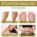 Lukmlca Bee Venom Foot Bath | Lymphatic Drainage & Wellness | International Shipping - Buy Online on GoSupps.com