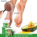 Heel Repair and Moisturizing Cream Rapid Cracked Repair Foot Cream Anti-Cracking Moisturizing Foot Cream Repairs and Moisturizes Dry Feet Fast Absorbing - Buy Online on GoSupps.com