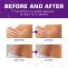 Kelinul Scar Cream - Silicone Gel for C-Section Stretch Marks & Acne Scars - 1.7 oz - Buy Online on GoSupps.com