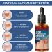 Ingrown Toenail Treatment Nail Growth Treatment Fungal Nail Treatment Ingrowing Toenail Treatment Ingrown Toenail Corrector Treatment for Ingrown Toenail Cuticle Oil Nail Strengthener for Damaged Nail - Buy Online on GoSupps.com