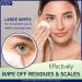 Dr. Fischer Premium Hypoallergenic Eyelid Wipes - 30 Pre-Moistened Cleansing Wipes for Gentle Makeup Removal - Buy Online on GoSupps.com