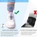 Upgraded Drop Foot Brace for Women & Kids - Adjustable Gray Orthosis with 3-Point Stability Fits Right/Left Foot | Medium Size - Buy Online on GoSupps.com