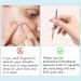 2-in-1 Facial Milia & Whitehead Extractor Tool for Pimple Acne Removal - 2pcs - Buy Online on GoSupps.com