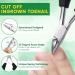 Ingrown Toenail Tools Kit - Stainless Steel Treatment & Corrector for Pain Relief | Pedicure Essentials - Buy Online on GoSupps.com