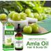 Amla Oil - Amla Hair Oil - Indian Amla Oil for Hair & Skincare - 100% Natural - Amla Oil for Natural Beautiful Long Soft & Strong Hair - Indian Hair Oil for Skin and Face (1) - Buy Online on GoSupps.com