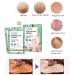Buy Joyeee Cornea Socks - 4 Pairs Foot Peel Mask for Callus Removal & Dry Skin Treatment - Buy Online on GoSupps.com