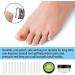 70PCS Ingrown Toenail Treatment Kit for Effective Pain Relief - Breathable Plastic Tool for Paronychia Patients - Buy Online on GoSupps.com