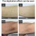 3-in-1 IPL Laser Hair Removal Device - Painless Fast & Effective for Men and Women | Home Use Full Body Elitzia Etippl3 - Buy Online on GoSupps.com