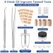 Professional Ingrown Toenail Treatment Kit - Includes Toenail Corrector, Tweezer, Strips, Braces, and Patches - Buy Online on GoSupps.com
