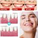 Gums Therapy Gel & Tooth Whitening Kit | 3-Piece Sensitive Teeth Solution - Buy Online on GoSupps.com