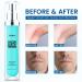Ingrown Hair Treatment | Razor Bumps Stopper for Men & Women | Upgraded Formula - Buy Online on GoSupps.com