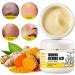 AILKE BOOST LUSTER AILKE Natural Turmeric Acne Remove Face Cream Brightening Reduce Blackheads Pimples With Niacinamide and Multiple Plant Extracts Clean Skin Unclog Pores 50g Pack of 3 - Buy Online on GoSupps.com