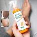 Xebular Immediate Foot Peeling Spray - Quick Dead Skin Removal & Foot Mask for Smooth Feet - Buy Online on GoSupps.com