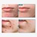 Adenosine Cica Cream 520 000ppm - Redness Reducing Moisturizer for Oily & Dry Skin | Korean Skincare with Niacinamide & Panthenol 100ml - Buy Online on GoSupps.com