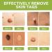 Skin Tag Removal Remover Kit Wart and Mole Remover Verruca Treatment for Hands Face Adults at Home 30ML - Buy Online on GoSupps.com